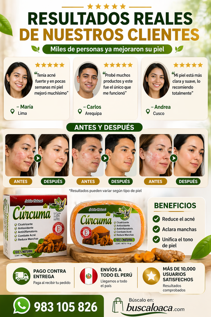 Jabón Cúrcuma ¿Cansado de probar productos que no funcionan?