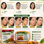 Jabón Cúrcuma ¿Cansado de probar productos que no funcionan?