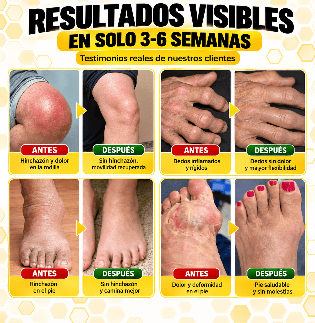 Elimina el dolor de raiz