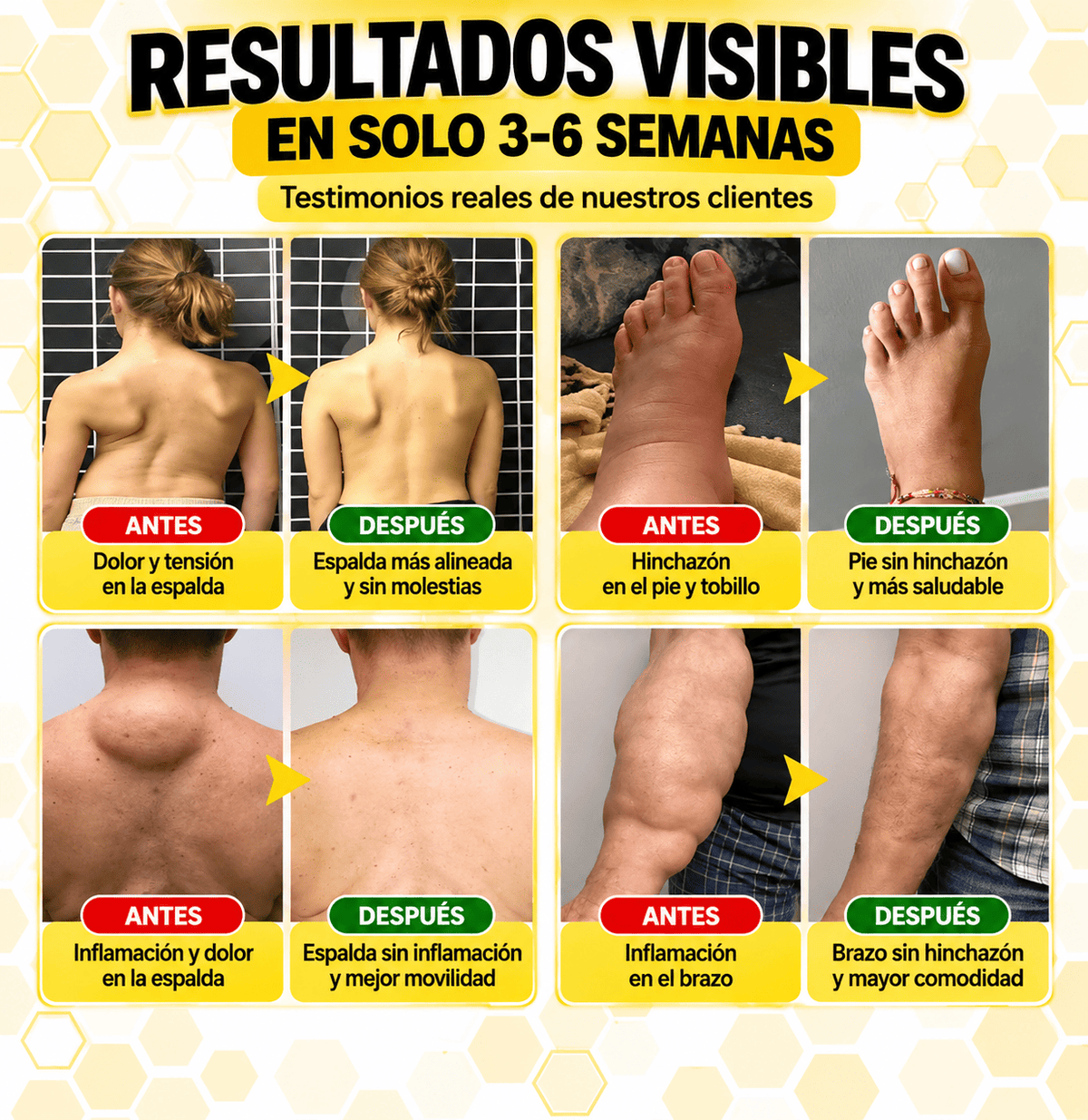 Elimina el dolor de raiz